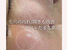 ココリール