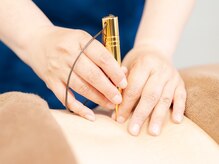 鍼が怖くても安心♪刺さない鍼にも変更できます★