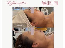 パルタージュ 三宮(Partage)/気になるフェイスラインにも