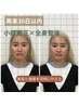 【再来30日以内】小顔×全身矯正整体90分 ¥12,400→8,800