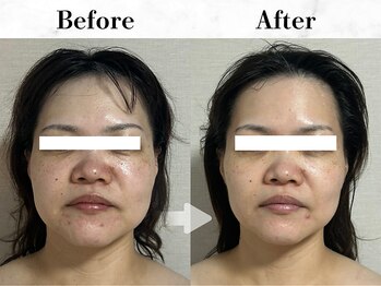 メイヴィ 四日市(Maivi)/40代女性の変化