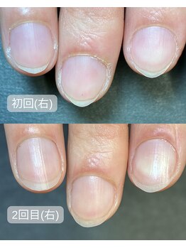 キラリネイル(KIRARINAIL)/お客さまの変化