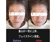 美容矯正サロン レレポノ(LELEPONO)/