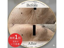 キュア(Cure)の雰囲気（施術の1例です。お写真の方は結構分かりやすいですよね。）