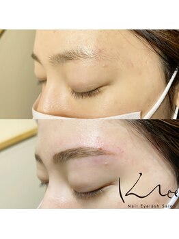 クレー(Klee)/アイブロウリフト