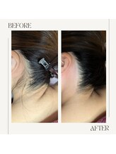 スプランドゥール(Splendeur)/うなじ　ワックス脱毛＆光脱毛