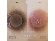 ミタス(Me+)/メラニンケア【ルメラ】乳輪