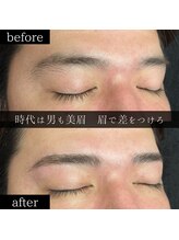 ユー 千葉駅前店(you)/ビフォーアフター写真