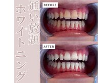 エクシアホワイトニング 碧南店の雰囲気（《セルフホワイトニング》月¥11000通い放題◎定額ホワイトニング）