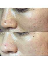 エミュ(emu)/くすみもぶっ飛び♪