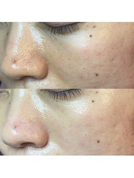 エミュ(emu)/くすみもぶっ飛び♪