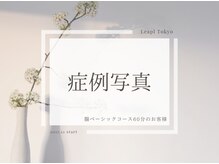 リープル(Leapl)/腸もみ症例写真[腸セラピー]