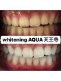 アクア 天王寺店(AQUA)&nbsp;セルフホワイトニング/大阪/天王寺/小顔/ホワイトニング/美白