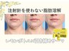 ブルドッグ/二重アゴ/顔の脂肪に【脂肪分解レモンボトル6cc】×引締めサーマ