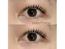 シュシュ(chou*chou)