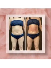 プリマプリート 可児店/大人気♪脂肪冷却！