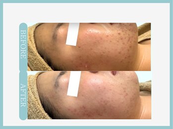 スリムライン 青森店(The Slim Line)/before→after