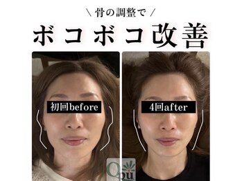 キュープ 高崎店(Qpu)/小顔頭蓋骨矯正＋美肌美顔器