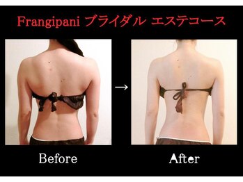 フランジパニ(Frangipani)/ブライダルコースご卒業♪