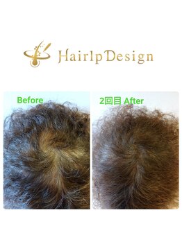 アボット キニー(Abbot Kinney)/