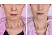 ソリシア(SORISIA)/