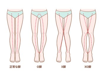 じん整骨院の写真/【身体の歪みでお悩みの方】必見！全身矯正で内股・X脚・O脚もサポート◎美姿勢を叶えます！☆