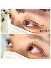 ヴィヴィアンジュ(viviange)/ラッシュリフト