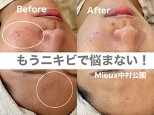 ミュー 中村公園店(mieux)