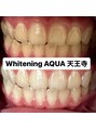 アクア 天王寺店(AQUA)&nbsp;セルフホワイトニング/大阪/天王寺/小顔/ホワイトニング/美白