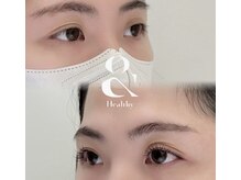 エイシェル/アンドヘルシー120本