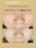 《毛穴洗浄×ハリツヤ》ハイドラ＋水玉グロウリフト(LDM)¥11000
