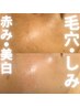 【くすみ/乾燥/赤ら顔】陶肌トリートメント/シルク・IPSPセラム【初回価格】