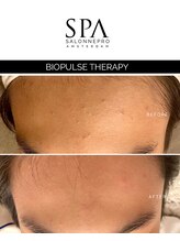 スキンラウンジ(SKIN LOUNGE)/欧州発ナチュラルリフト