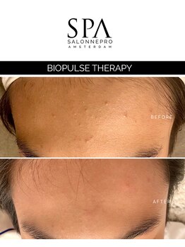 スキンラウンジ(SKIN LOUNGE)/欧州発ナチュラルリフト