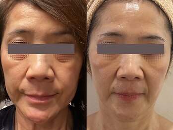 リボーン 柏(REBORN)/【再生美容】上品ツヤ肌へ