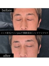ユー 千葉駅前店(you)/ビフォ－アフター写真