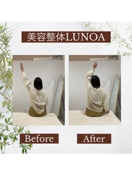 美容整体LUNOA　神戸三宮院/[三ノ宮/美容整体/整体/肩こり]