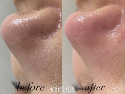 リスポアラボ(LIS PORE.LAB)の写真