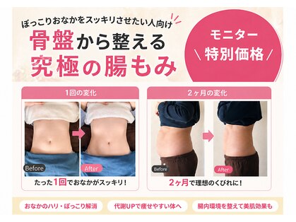 ヴィアスエイト(Vias∞)の写真