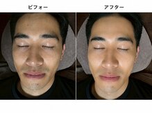 キメル(KIMERU)/眉毛/メンズ/眉毛サロン/KIMERU