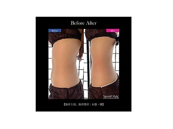 ボディトーン(bodytone)/脂肪燃焼メニュー