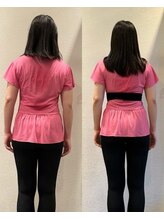 ホリック アイス コア ボディ(HOLIC ICE CORE BODY)/お客様のビフォーアフター10