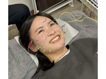 ハリーズエヌ(harry's N)の雰囲気（鍼の初心者も大歓迎♪）