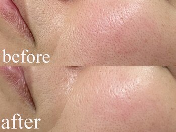 ビューティー サロン アイビー(Ivy)/ララピール