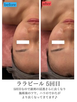 ユフラ(Juhla)/ララピール