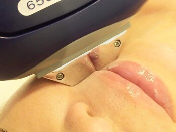 カンパニュラ(campanula)の写真/【お顔脱毛で毛穴レスな肌へ♪】全身脱毛も丁寧!早いと好評!都度払い脱毛で気軽に通える♪