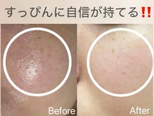 ルンルン(run run)/