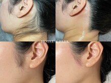 ホテルアンドパーク(HOTEL&PARK.)