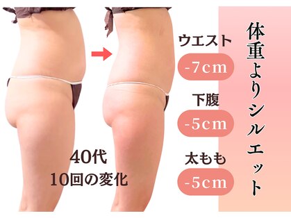 エルナ(Eluna)の写真