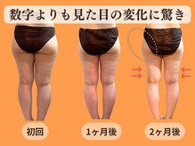 ヨサパーク 美 キレイ(YOSA PARK 美 Kirei)
